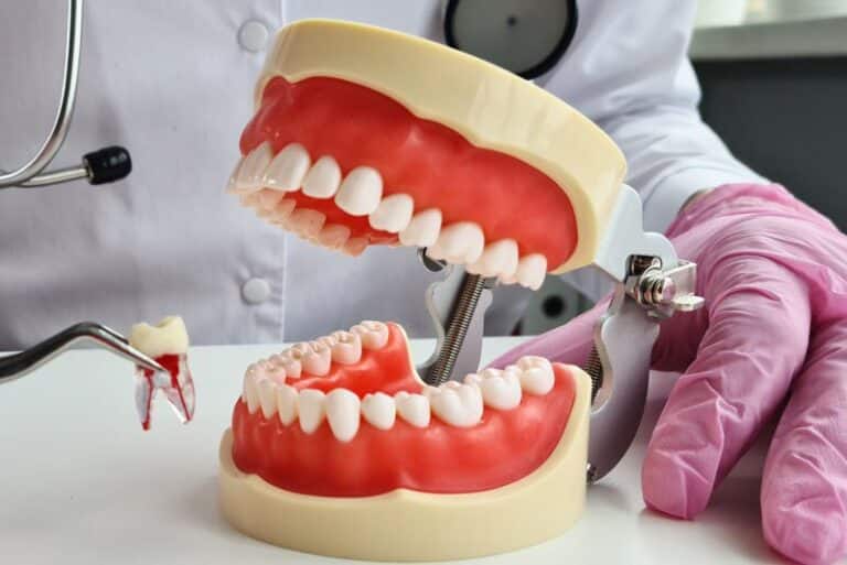 a full mouth model single tooth extraction, Why Would I Get Dental Implants After a Tooth Extraction?