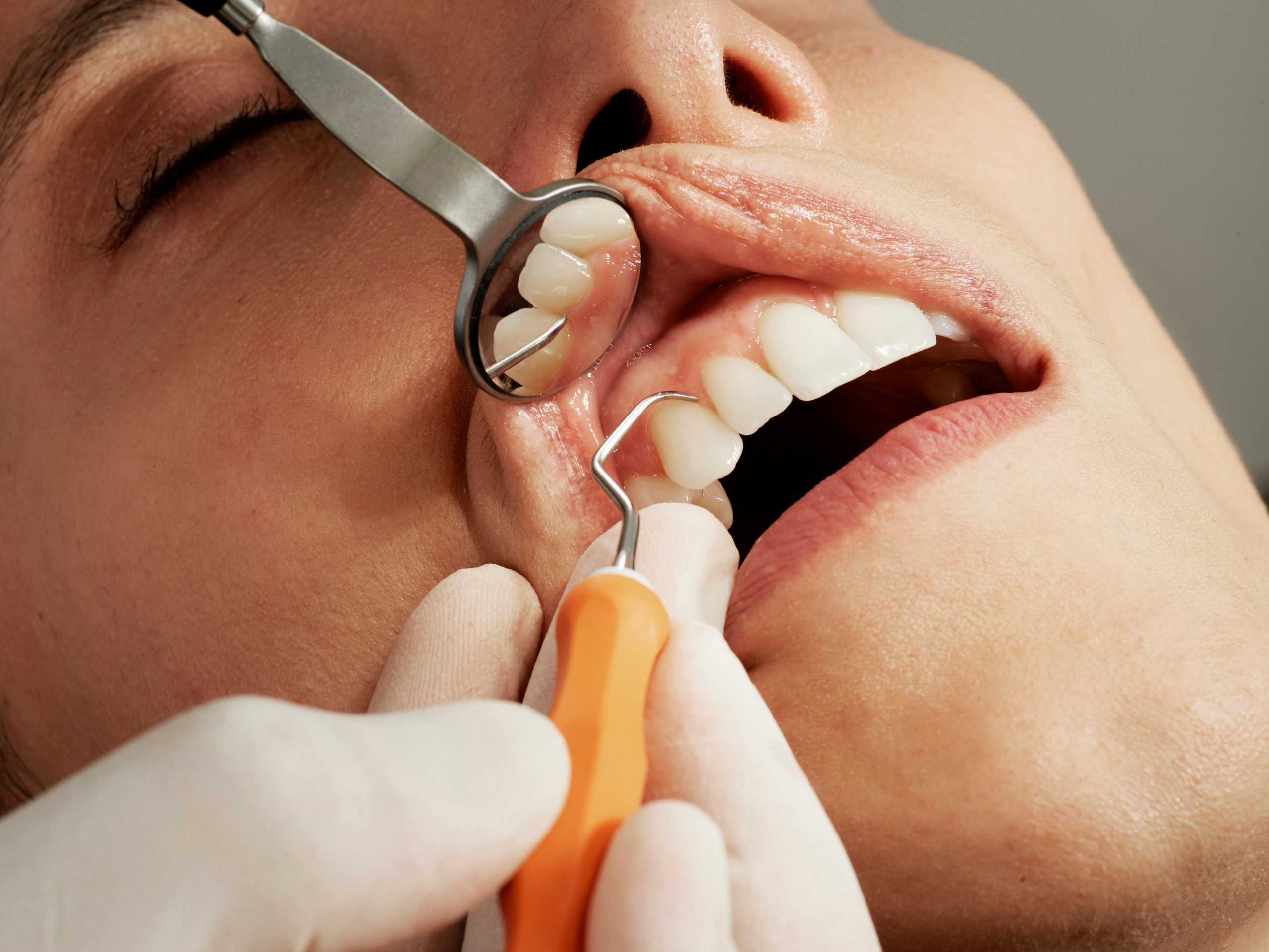 Photo for Find Out How Much Teeth Cleaning Costs Without Insurance