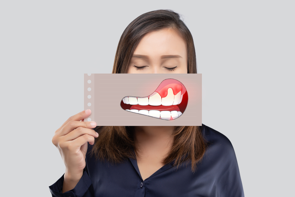 Photo for Understanding and Treating Periodontal Disease in Hamilton and Columbus, GA