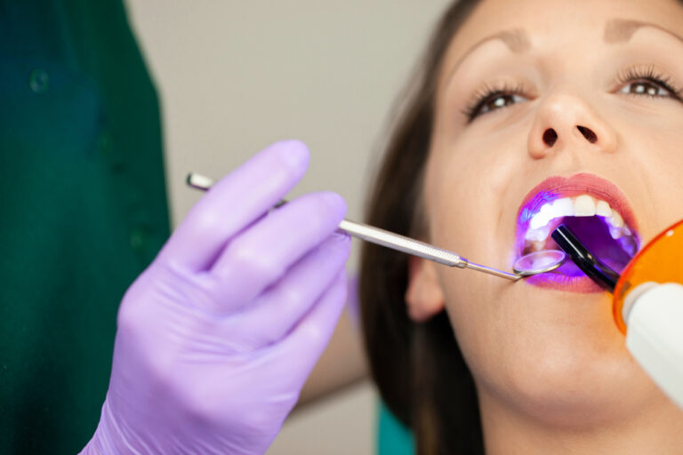 shutterstock 1513369823 1, Everything You Need To Know About Composite Bonding