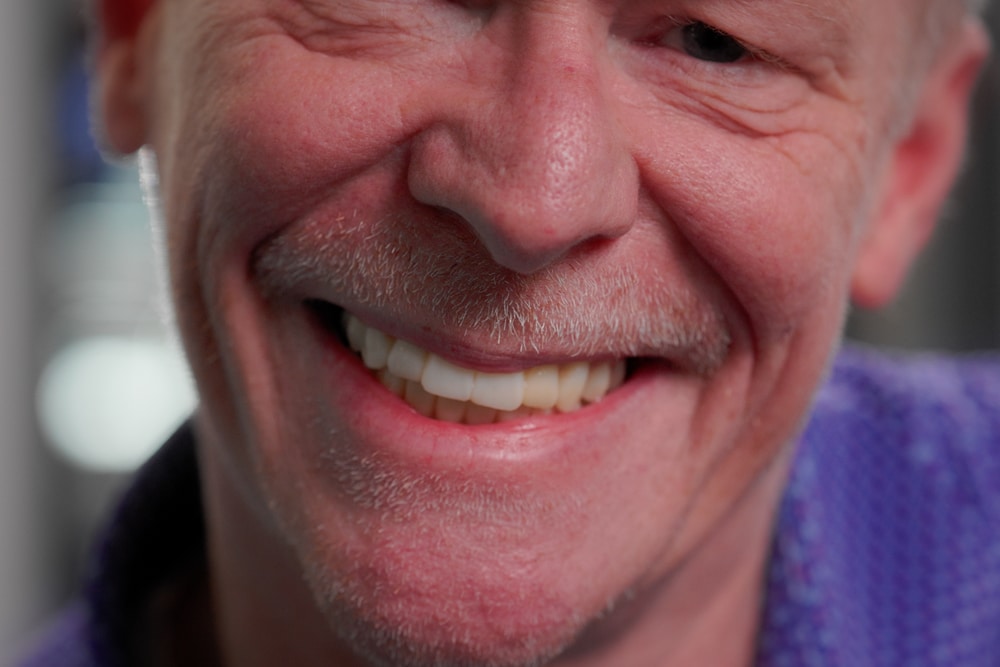 The Benefits of Dental Crowns