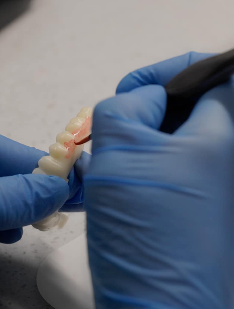 Benefits of Dental Implants