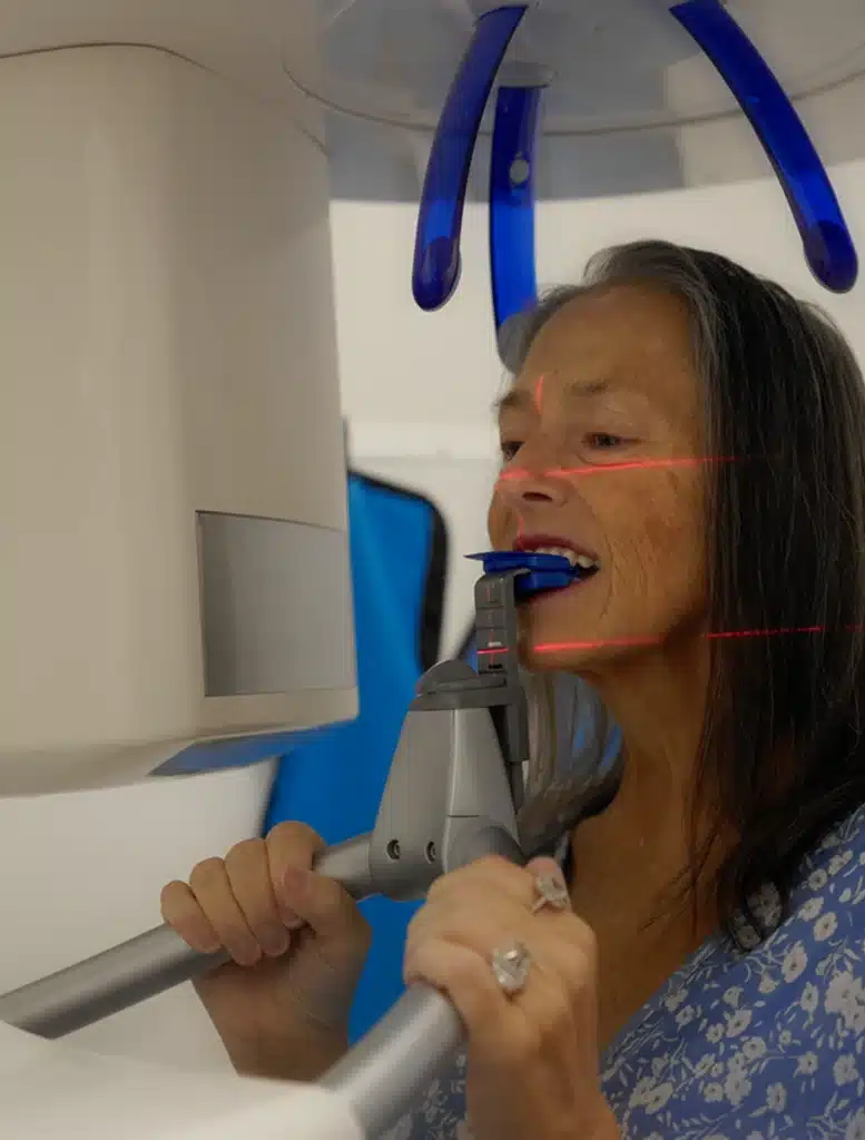 Benefits of Fixed Full-Arch Dental Implants