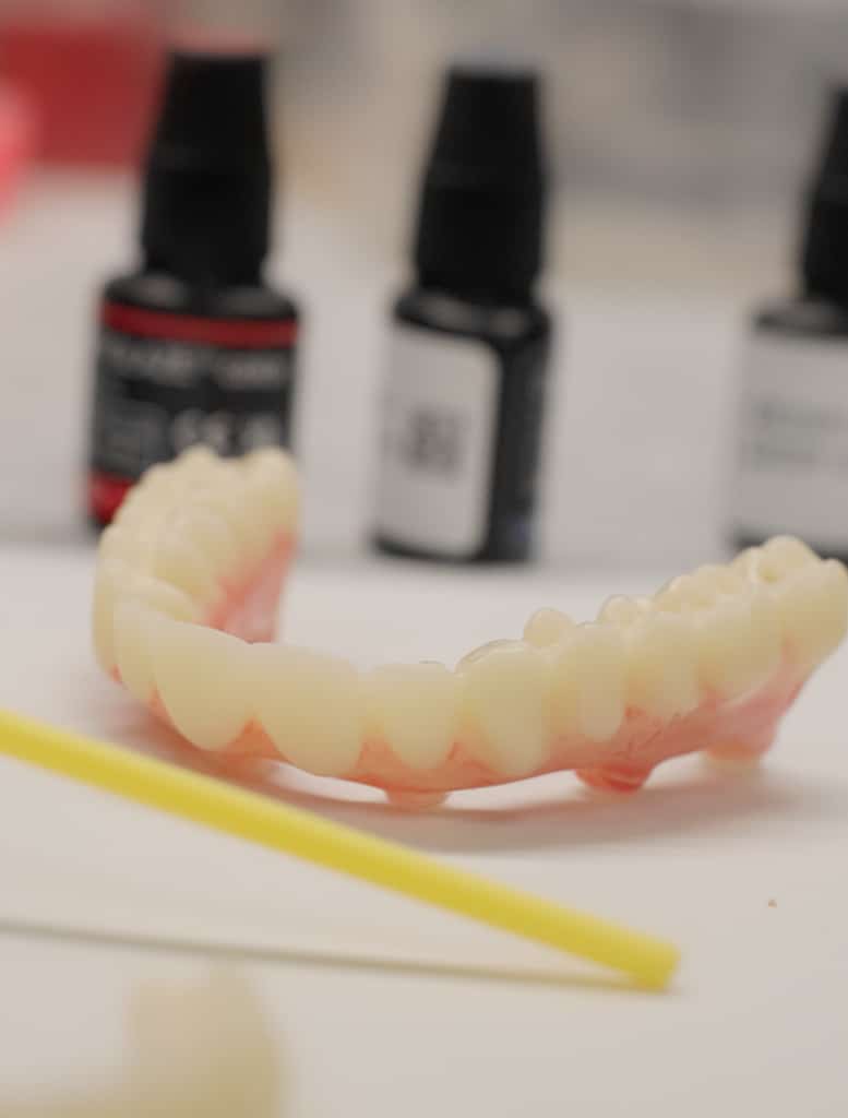Benefits of an Implant Supported